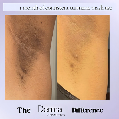 Derma Hair Turmeric Hair Removal Cream